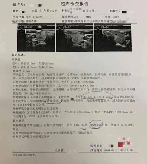 乳腺癌,洗澡,自摸,发现,肿块