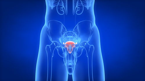 前列腺癌- PSA指标忽高忽低，泌尿外科医生说：检查前三天别做这件事