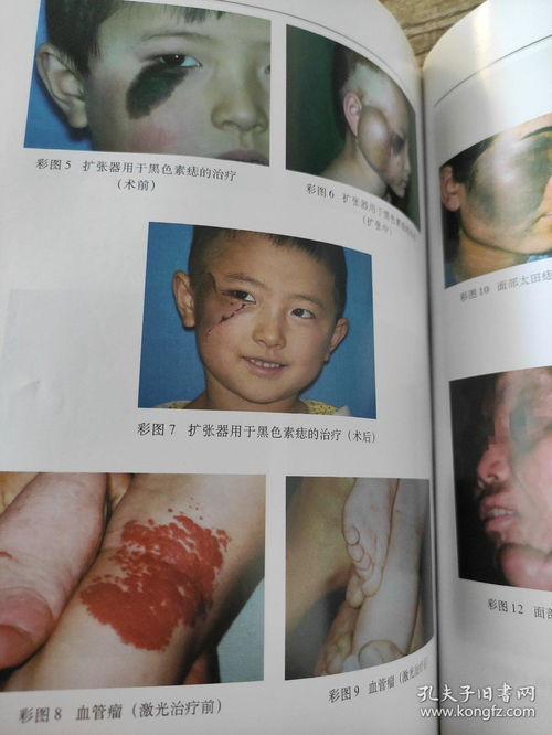 黄疸-皮肤眼睛发黄当肝炎治，胆道外科医生查出胰头占位