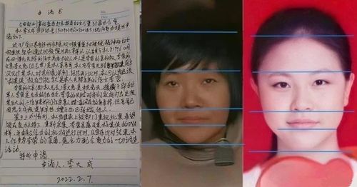 视网膜母细胞瘤-儿童白瞳症，眼底检查发现