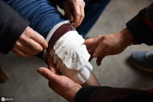 肉瘤,篮球,扭伤,膝盖,一个月