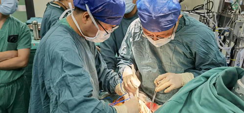 腹痛-上腹痛当胃病治了三年，肝胆外科查出胆总管结石