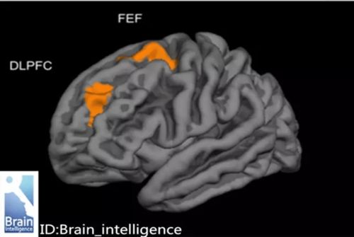 脑胶质瘤-视力下降看眼科没问题，神经外科医生让查视野发现颅内占位