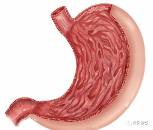 胃溃疡-胃溃疡反复发作，最后切胃的病人，术前问了医生一句话