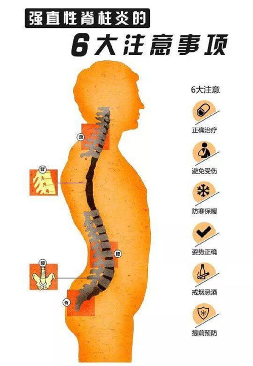 HLA-B27：强直性脊柱炎相关基因