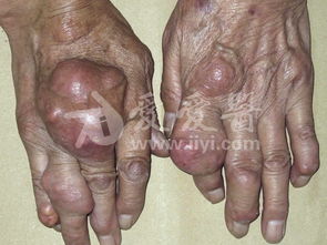 全军,皮肤性病,中心