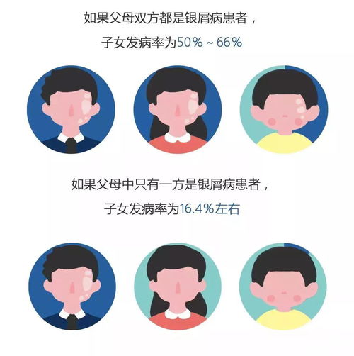 小儿deucravacitinib能治银屑病吗