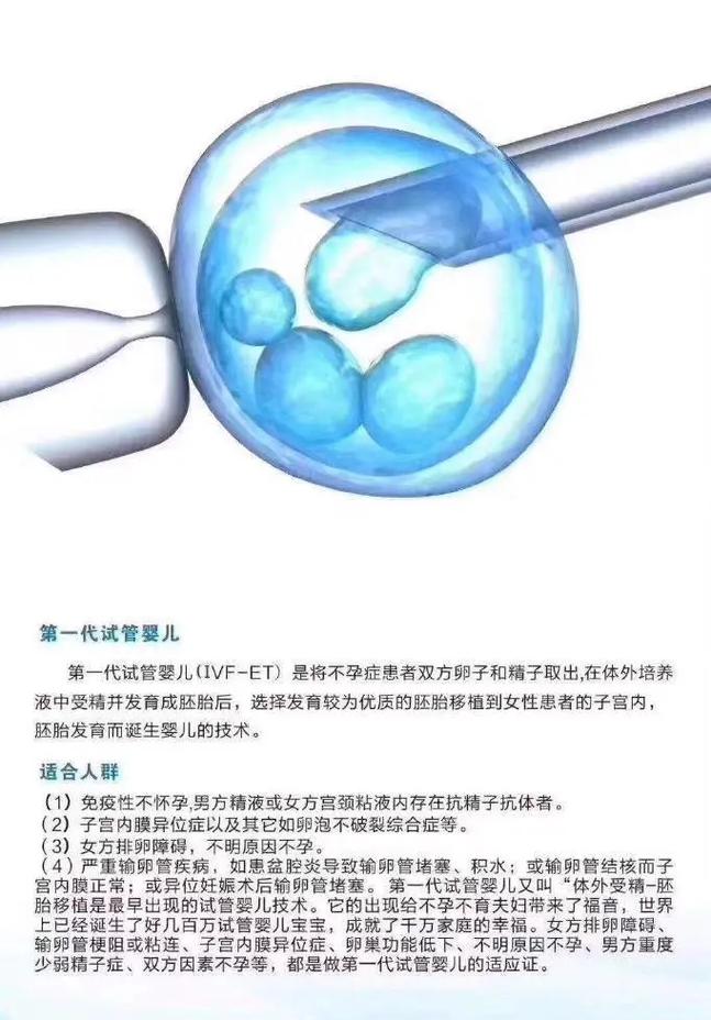 2代试管婴儿