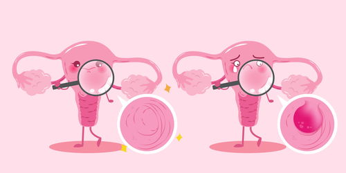 2代试管婴儿，做试管婴儿具体流程