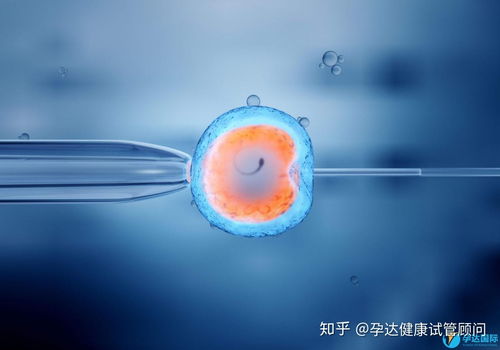 45岁做试管婴儿