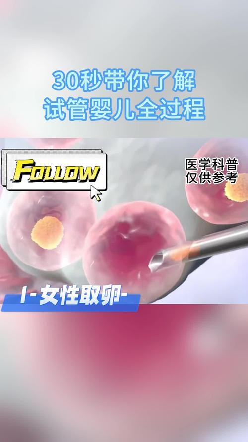 48岁做试管婴儿吗