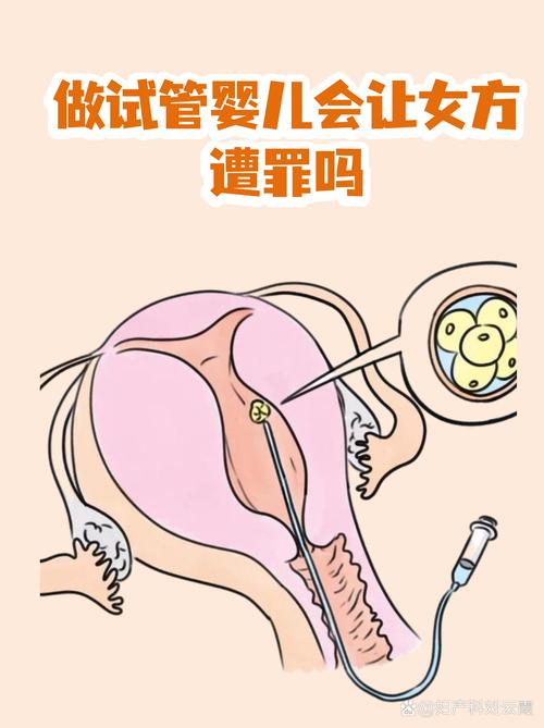 48岁可以做试管婴儿吗