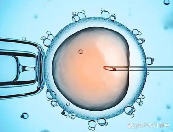 45岁,能做,试管婴儿