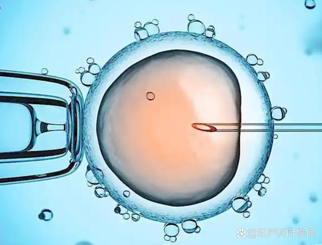 45岁能做试管婴儿吗