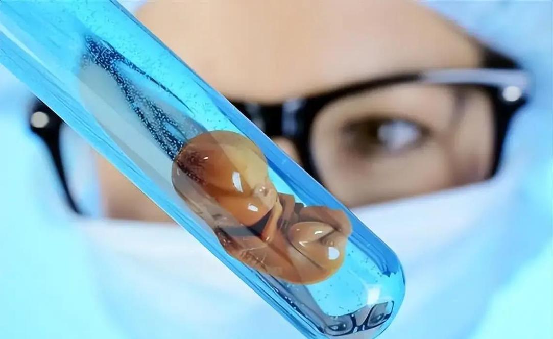 48岁做试管婴儿