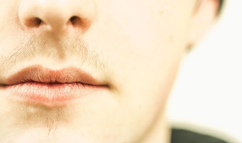 肝硬化-面色发黑蜘蛛痣出现，肝病科医生：这是肝硬化失代偿期的典型体征