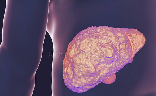 肝癌-手术切除了肝癌，五年没复发是不是就治愈了？肝胆外科医生摇头