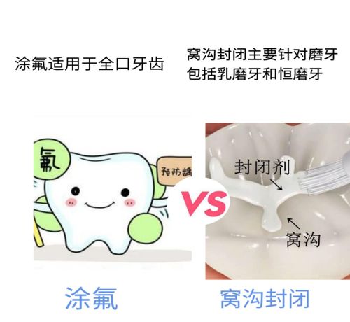 儿童蛀牙怎么预防