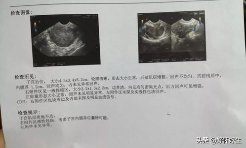 hpv阳性能做试管婴儿吗