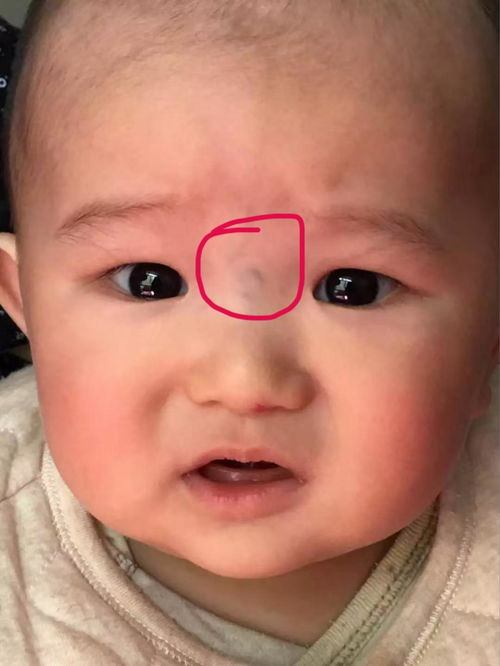 小儿,艾伏,尼布,能治,什么