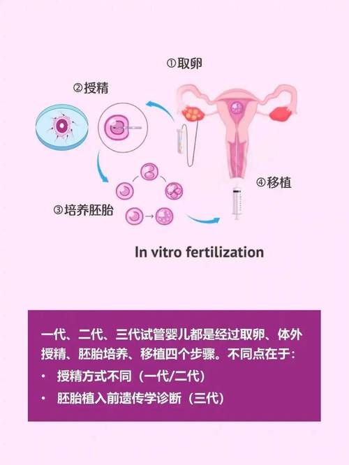 三代试管婴儿技术