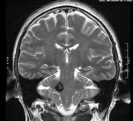 国家,脑损伤,临床,研究中心