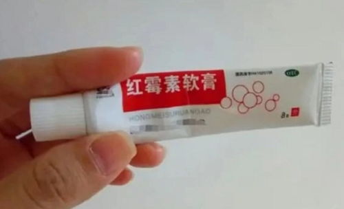 红霉素软膏和金霉素软膏有什么区别