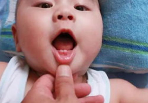 宝宝出牙晚怎么办