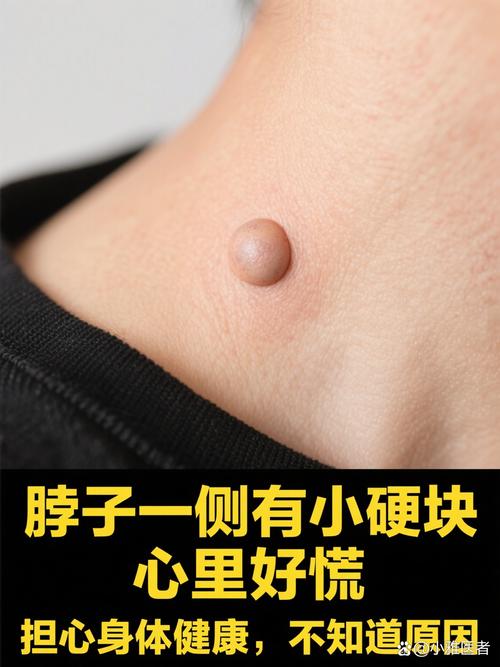 上有疙瘩摸到小硬块要当心