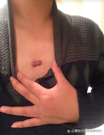 上有疙瘩摸到小硬块要当心