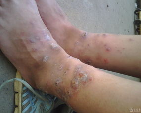 上有疙瘩摸到小硬块要当心