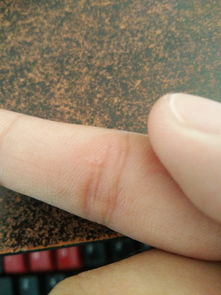 三棱破血，三棱丸