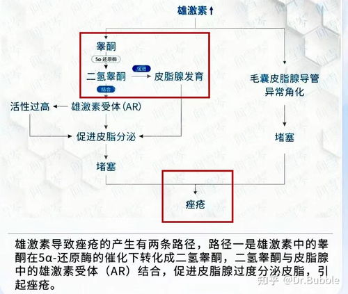 5α还原酶缺乏症