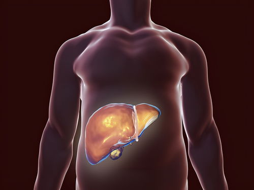 中度脂肪肝逆转食谱坚持半年肝脏变干净