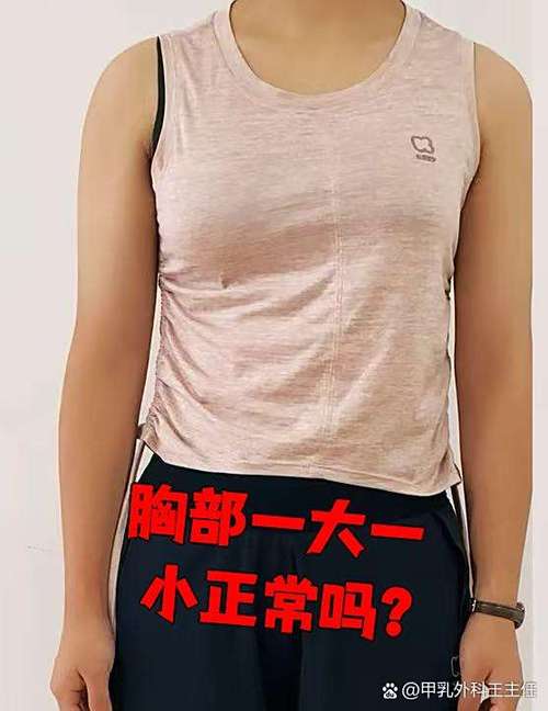 一个大一个小正常吗