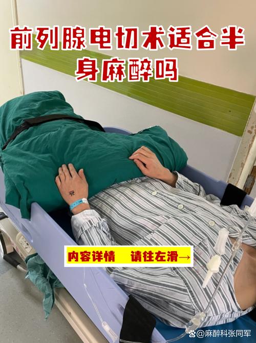 前列腺增生手术做电切还是激光