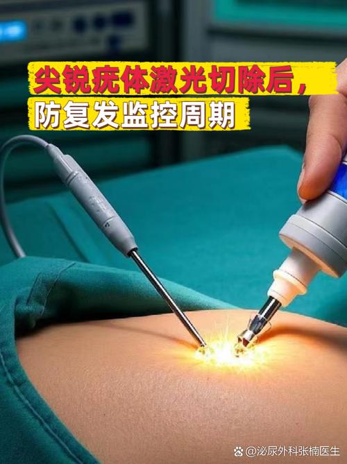 前列腺增生手术做电切还是激光