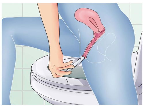 TRAM皮瓣和DIEP皮瓣有什么区别哪个创伤小