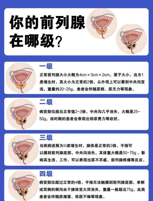 前列腺大小正常值是多少