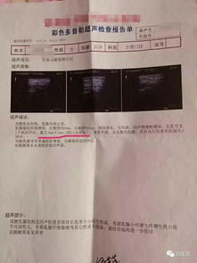 乳腺B超能查出什么BI-RADS分级怎么看