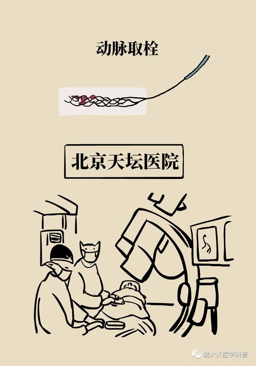 会坠胀总觉得有东西堵着