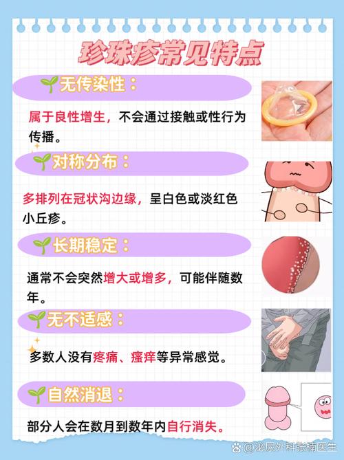 冠状沟珍珠疹需要治疗吗