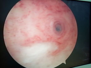 中药调理内膜什么方子能长内膜