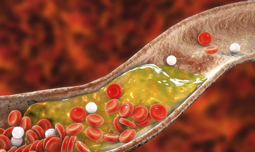 低密度脂蛋白高：被称为坏胆固醇的食物黑名单