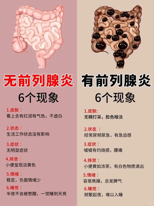 前列腺炎,急性,慢性,怎么,区分