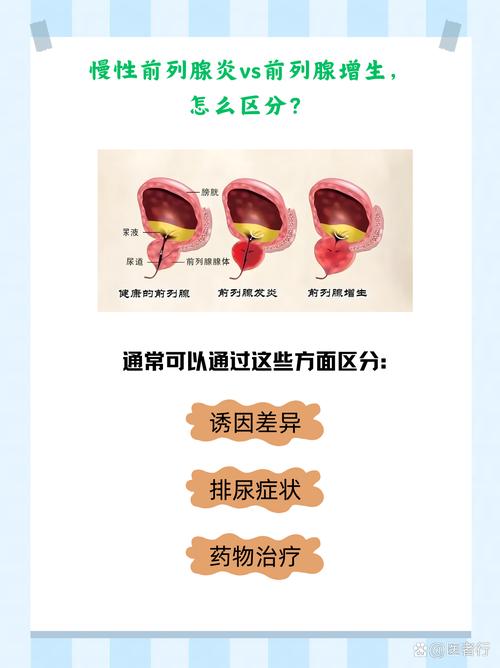 前列腺炎分急性和慢性怎么区分
