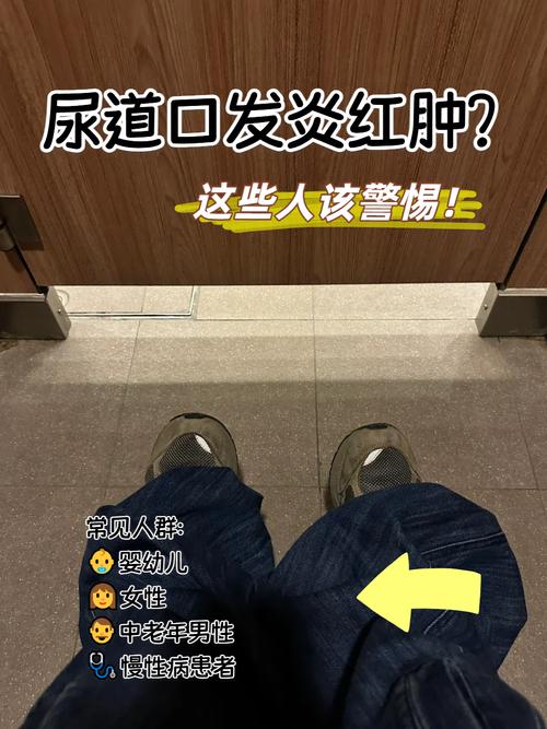 尿道口刺痛排尿像刀割一样
