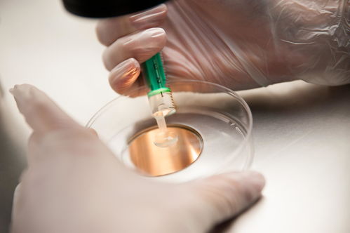 梗阻性无精症能疏通吗