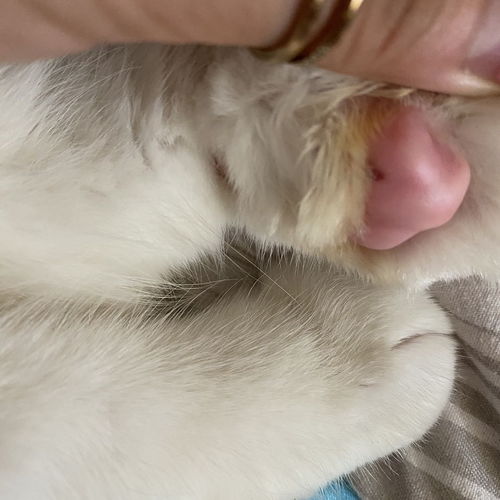 炎反反复复发作怎么根治