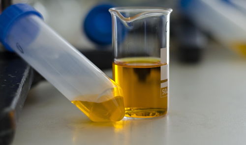 溶血性贫血-酱油色尿当血尿，肾内科医生说可能是溶血